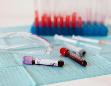 Cepivo proti modrikastem jeziku bo brezplačno